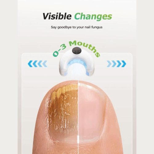 LumoNail (official Retailer) 2025